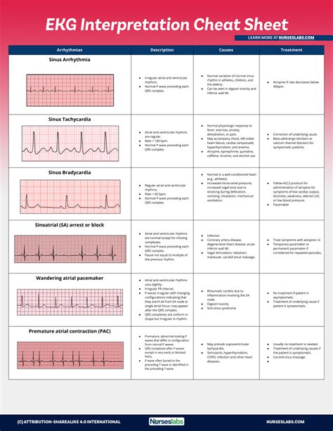 abnormal ekg readings